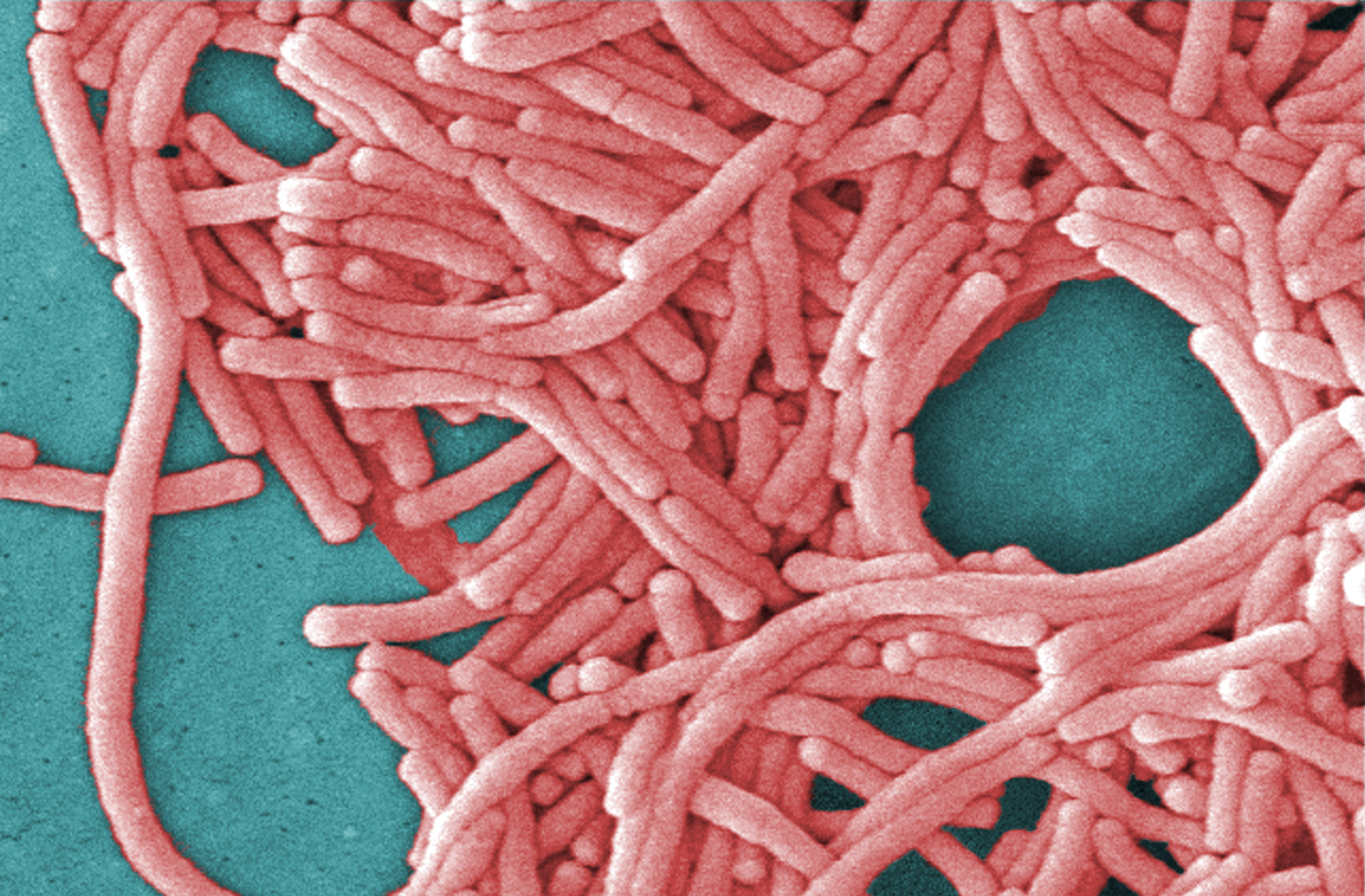 Legionella Bacteria Found At Pittsburgh Hospital Kgw